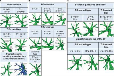 Analysis of bronchovascular patterns in the left superior division segment to explore the relationship between the descending bronchus and the artery crossing intersegmental planes